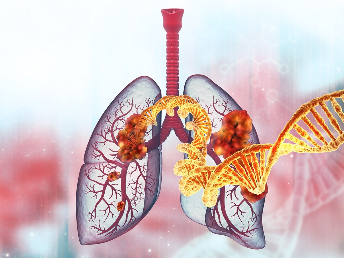 Key updates to watch at #WCLC26 https://t.co/Ls3ck5LGWg #biopharma #lungcancer #oncology #