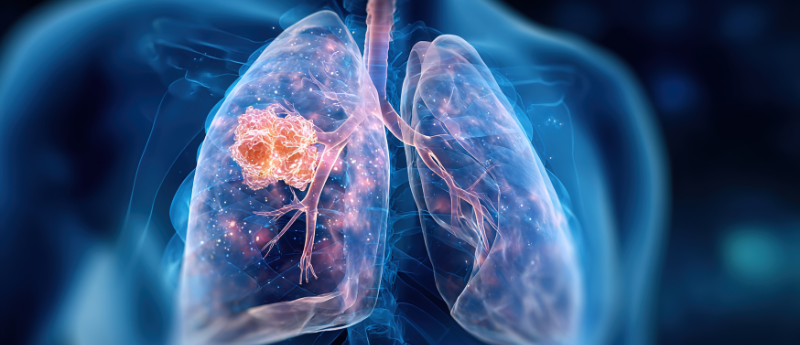 📢Landmark 8-year update from the Phase III ADAURA trial
Adjuvant osimertinib continues to